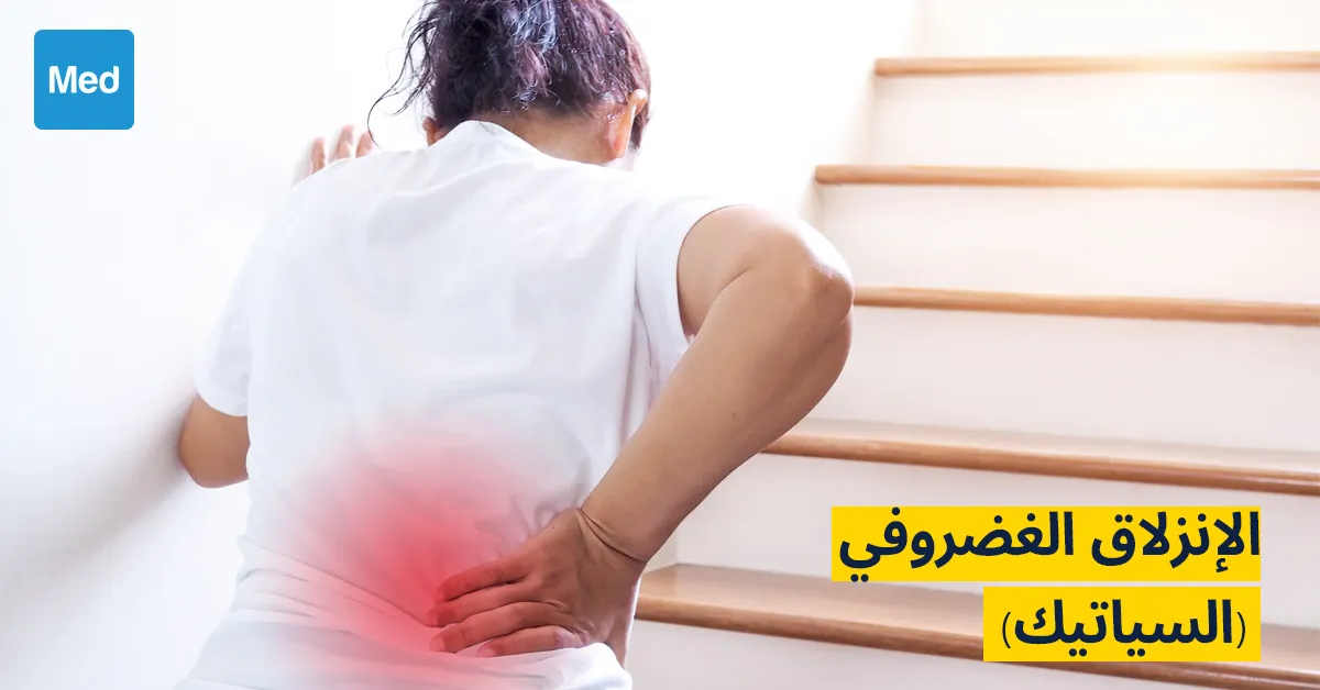 الإنزلاق الغضروفي (السياتيك): الأسباب والأعراض والتشخيص والعلاج